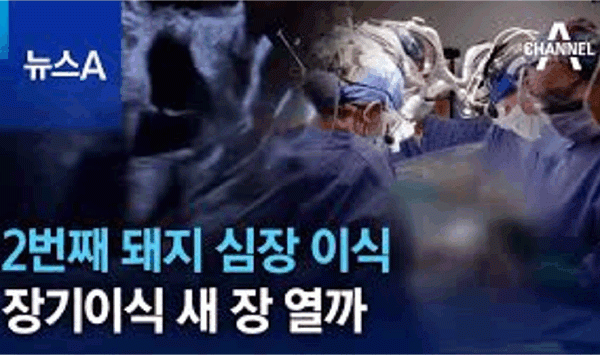 2번째 돼지 심장 이식…장기이식 새 장 열까