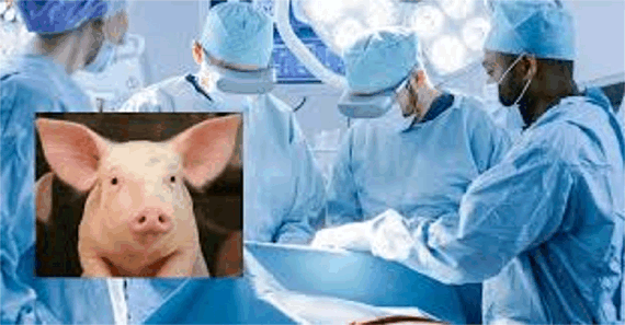 미국 60대 환자에 돼지신장 이식…“현재 양호” 2024 년