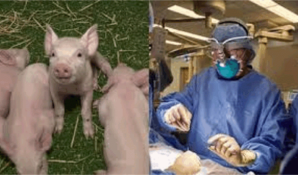 유전자 조작으로 거부 반응 없는 돼지 신장의 이식 성공